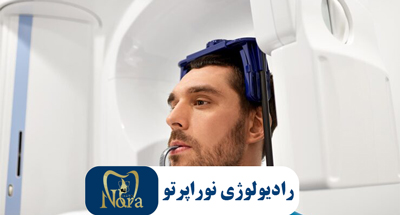 رادیوگرافی های داخل دهانی ،انواع و کاربرد