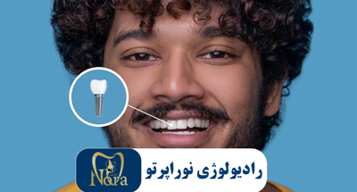 رادیوگرافی های مورد نیاز برای کاشت ایمپلنت