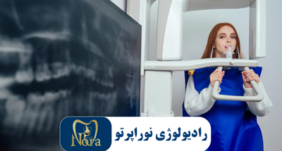 رادیوگرافی پانورکس (OPG) و مزایای آن در دندان‌پزشکی