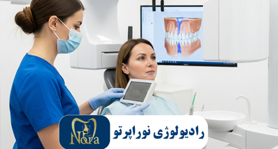 رادیوگرافی بایت وینگ | تشخیص دقیق پوسیدگی‌های بین دندانی