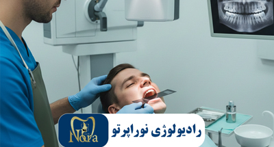 رادیوگرافی اکلوزال | دندان‌های نهفته و مسیر رویش با دوز کم