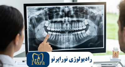 فاصله مجاز بین رادیوگرافی دندان چقدر است؟ بررسی ایمنی اشعه